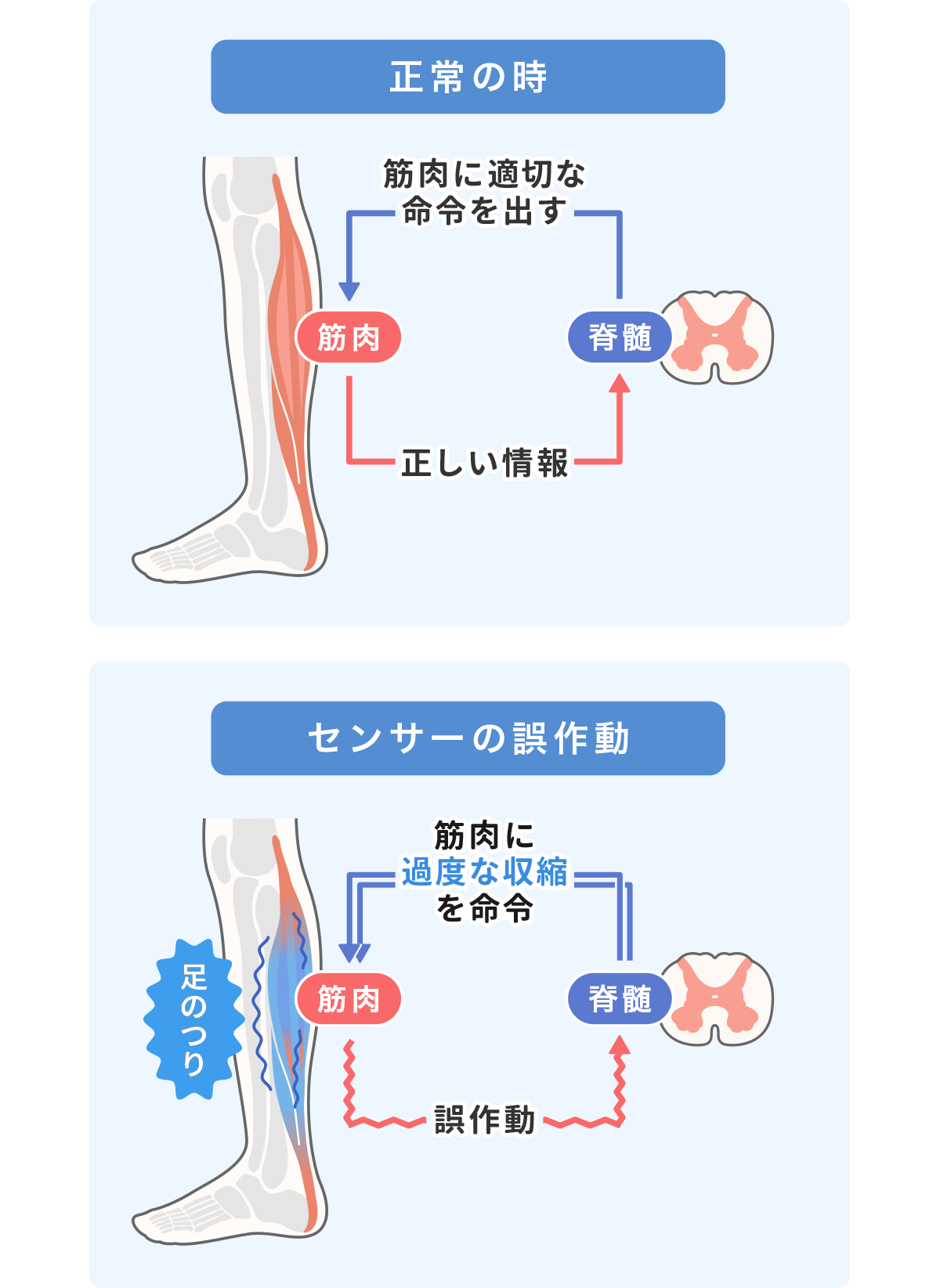 足がつる(こむら返り)原因のイメージ