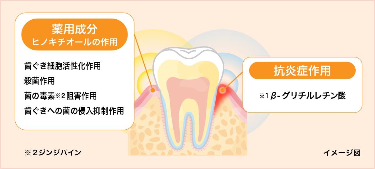 歯ぐきの腫れ・出血を伴う歯槽膿漏を防ぐ