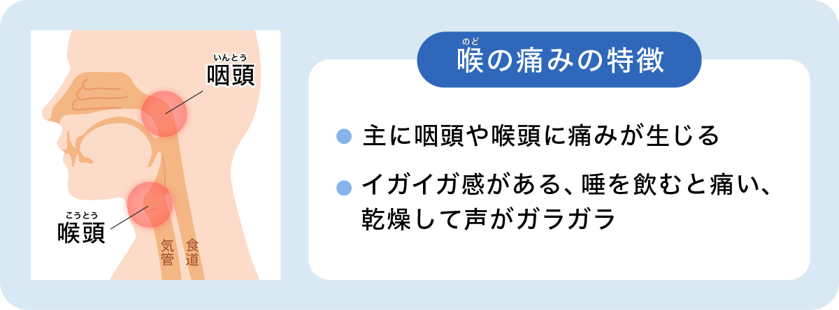 のど(喉)の痛みの特徴